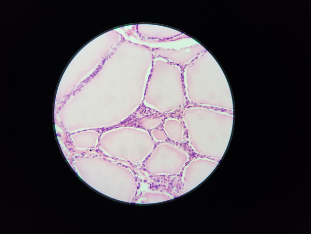 Parathyroid Thyroid Slides - Parathyroid_Thyroid 009 400X